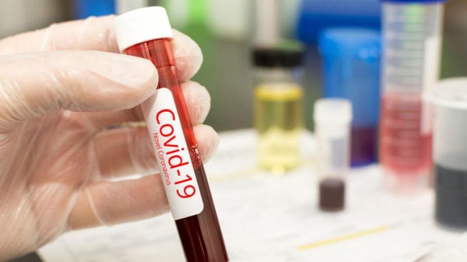 Германия изисква представяне на отрицателен PCR тест и за транзитно
