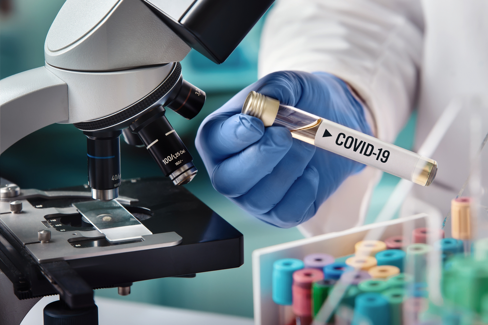 Проба на заразен с COVID 19 пациент от Плевен е установена