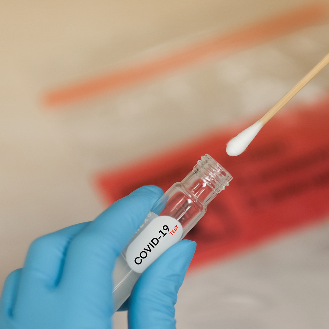 28 оферти за щадящи антигенни тестове за тестване на учениците