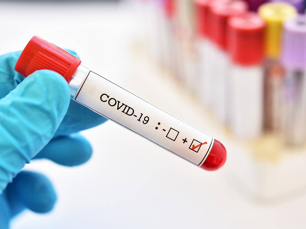 9996 са новите случаи на коронавирус у нас, сочат актуализираните
