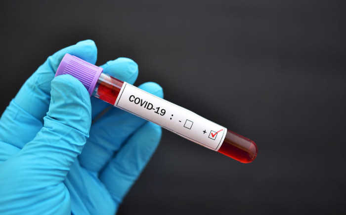 Испания е в седмата вълна на коронавируса. Натискът върху болниците