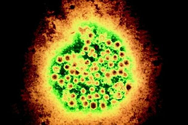 Нов хенипавирус открит в Китай може да бъде върхът на